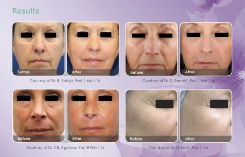 tratamientos estéticos