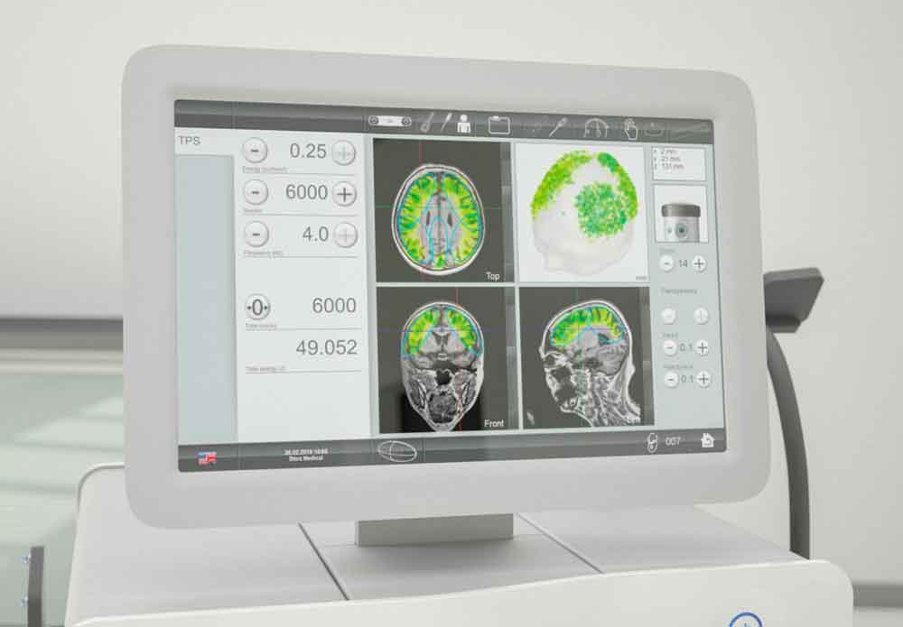 Neurolith para el tratamiento de la depresión