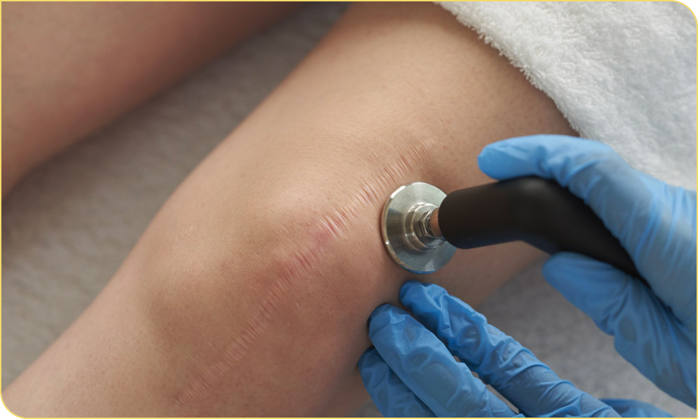 Tratamiento INDIBA radiofrecuencia corporal fisioterapia