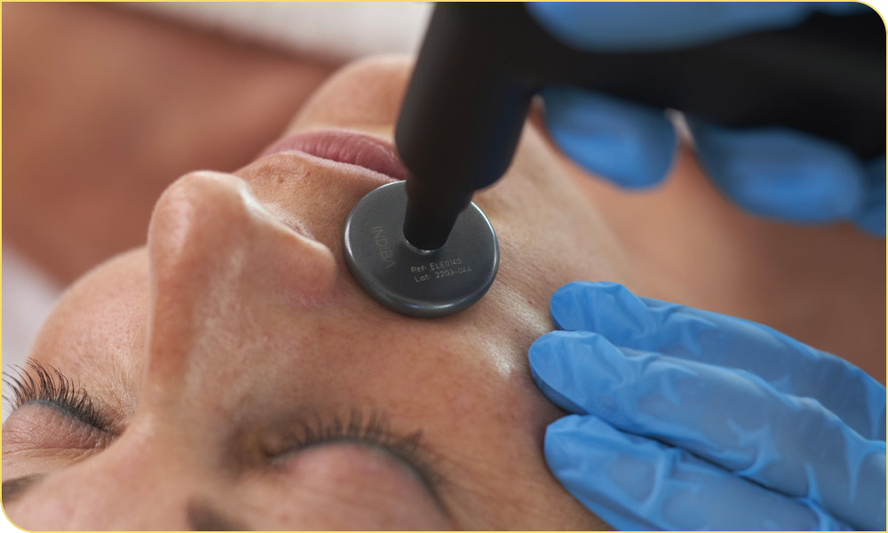 Tratamiento INDIBA radiofrecuencia facial